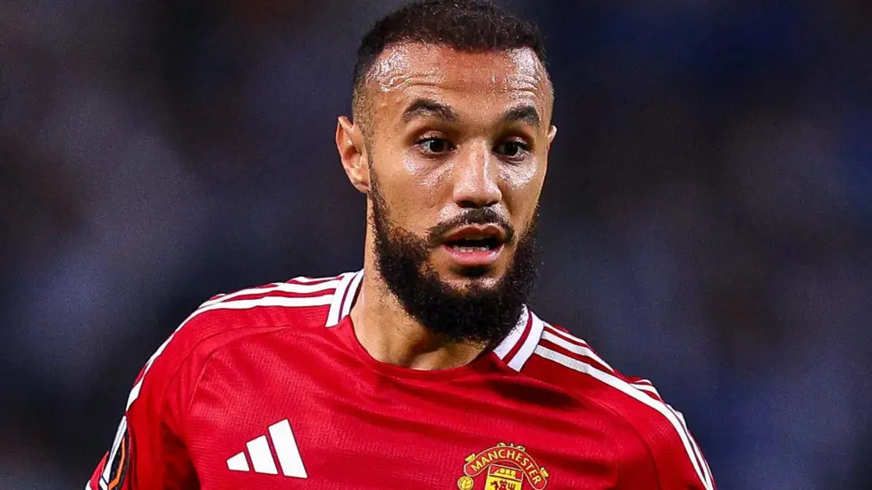 Man Utd’s Mazraoui has minor procedure after palpitations